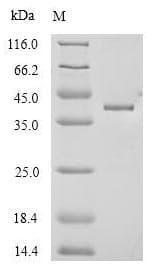 Mouse ANTXR1 / TEM8 Protein (Recombinant 6His, N-terminus)