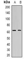 Polyclonal Rabbit anti-Human PTBP1 Antibody (WB)