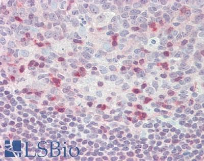 IHC-plus™ IRF1 / MAR Antibody (aa74-102)