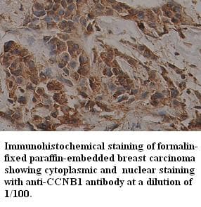 Polyclonal Rabbit anti-Human CCNB1 / Cyclin B1 Antibody (N-Terminus, IHC)