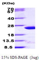 Human ARF4 Protein (Recombinant His)