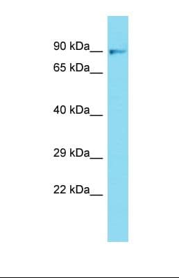 FGFR1 / FGF Receptor 1 Antibody (aa112-161)