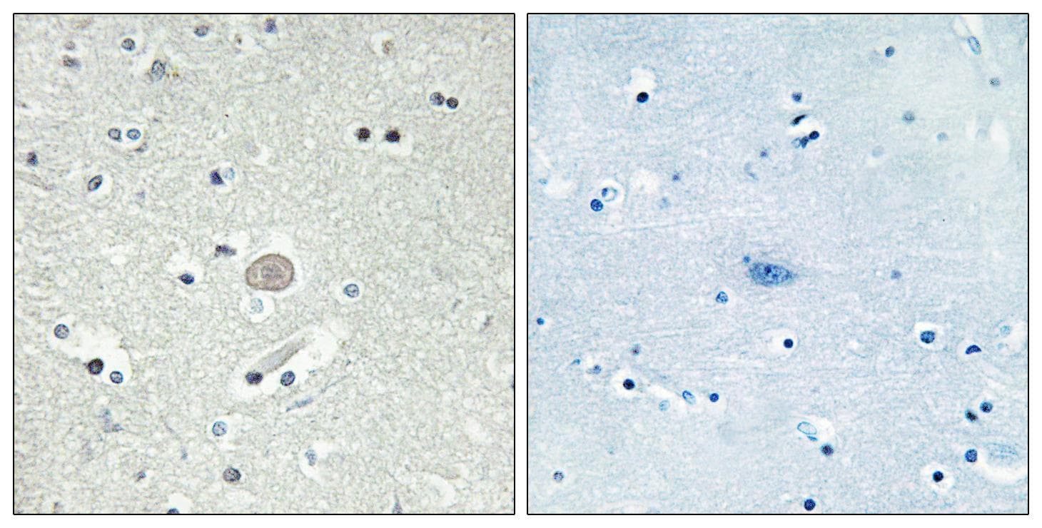 CX3CR1 Antibody