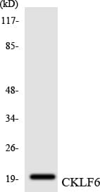 CMTM6 / CKLFSF6 Antibody (aa120-169)