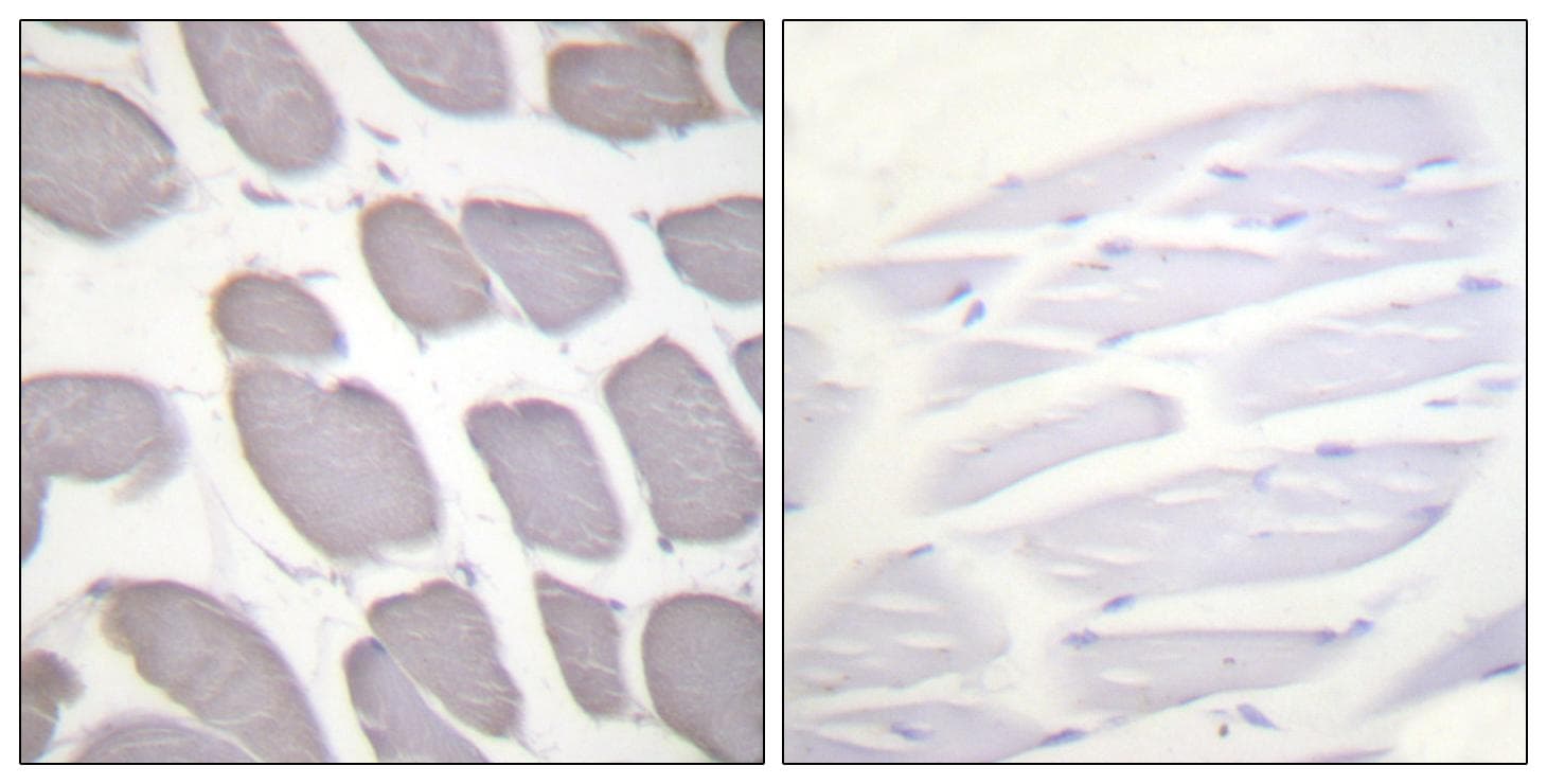 Polyclonal Rabbit anti-Human PRKAB1 / AMPK Beta 1 Antibody (p181, IHC, WB)