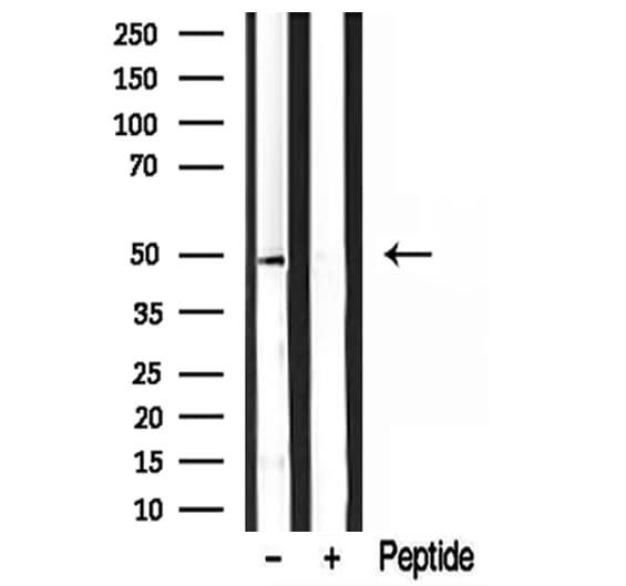 Polyclonal Rabbit anti-Human DEK Antibody (IHC, IF, WB)
