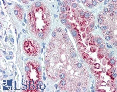 IHC-plus™ IGFBP6 Antibody