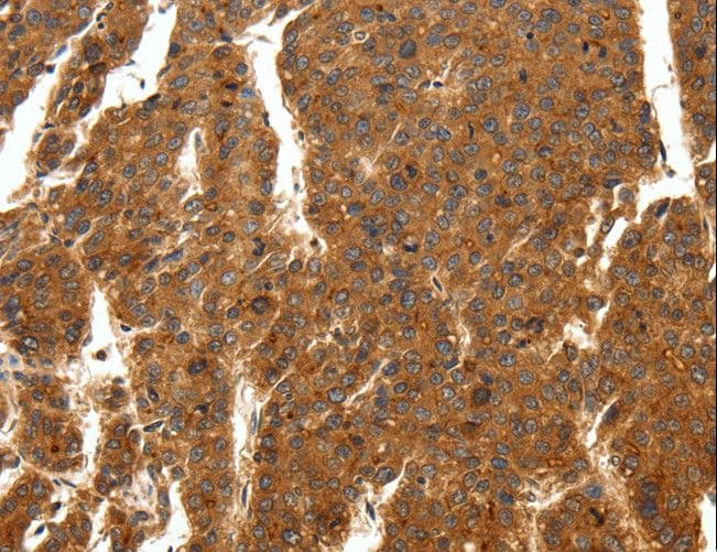 SCN11A / Nav1.9 Antibody