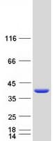 Human SIKE1 Protein (Recombinant Myc-DDK (Flag))