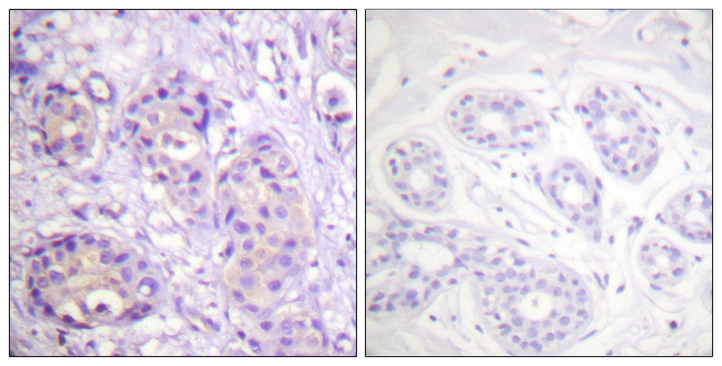 IKBKB / IKK2 / IKK Beta Antibody (phospho-Tyr199)
