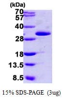 Human GCL / Grancalcin Protein (Recombinant His)