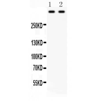 Polyclonal Rabbit anti-Human PLEC / Plectin Antibody (aa2644-2671, IHC, WB)