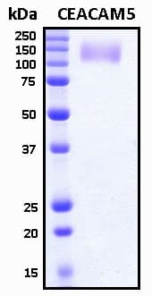 Human CEA / Carcinoembryonic Antigen Protein (Recombinant 6His, N-terminus)