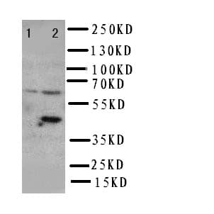 SLC22A6 / OAT1 Antibody (aa534-550)