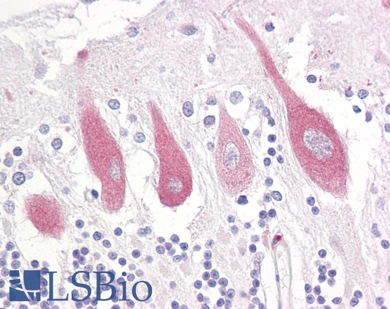 IHC-plus™ ITPR1 / IP3 Receptor Type 1 Antibody (aa1566-1615)