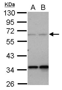 PPP4R2 Antibody