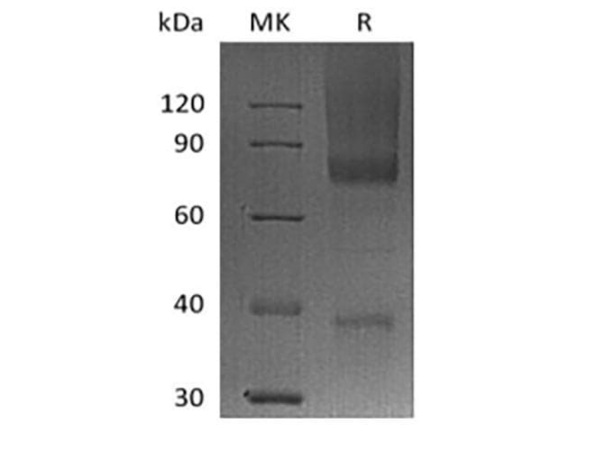 Human GPC3 / Glypican 3 Protein (Recombinant AVI-6His, C-terminus)