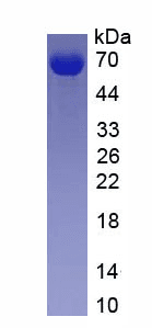 Mouse AGT / Angiotensinogen Protein (Recombinant His, N-Terminal)