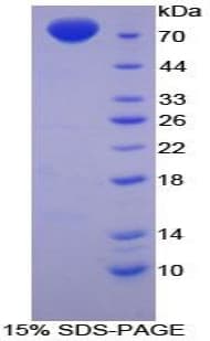 Chicken ENO3 / Enolase 3 Protein (Recombinant His-GST)