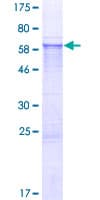 Human ERCC1 Protein (Recombinant GST)