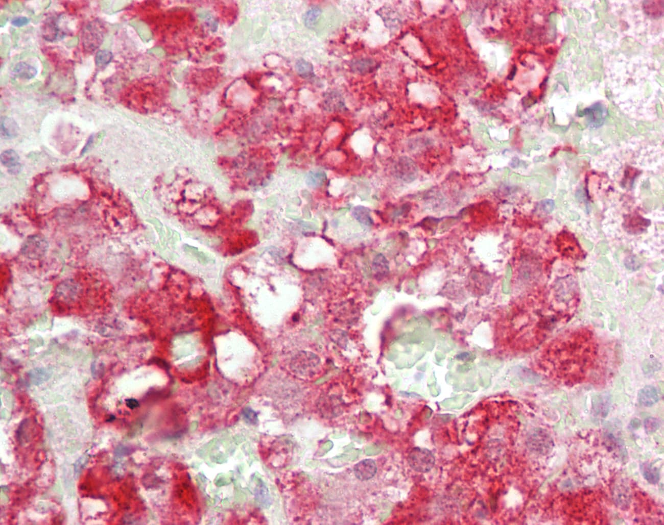 IHC-plus™ Polyclonal Rabbit anti-Human LCX / TET1 Antibody (IHC, IF, WB)