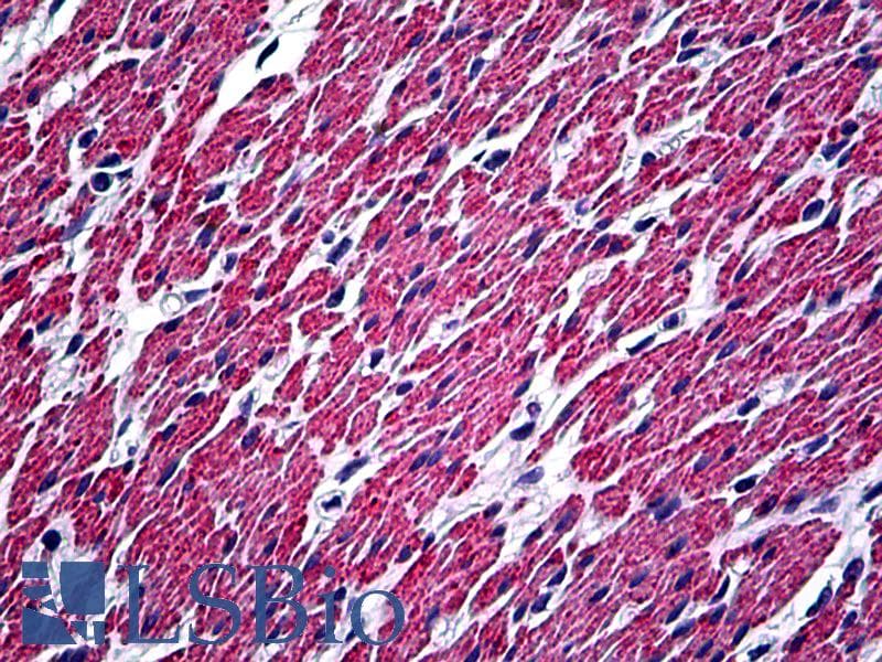 PathPlus™ DES / Desmin Antibody (clone D33, Concentrated)