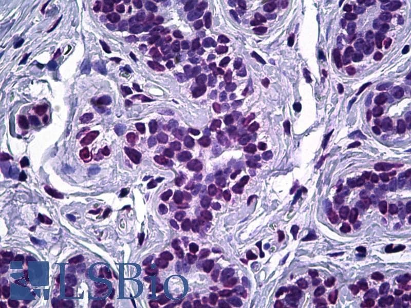 IHC-plus™ ELAC2 Antibody (aa161-210)