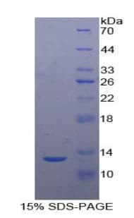 Human UTS2 / Urotensin II Protein (Recombinant His)