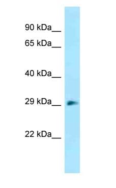 Polyclonal Rabbit anti-Mouse DNAJC27 Antibody (aa52-101, WB)