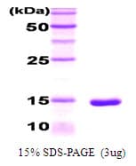 Human C/EBP Alpha / CEBPA Protein (Recombinant His)