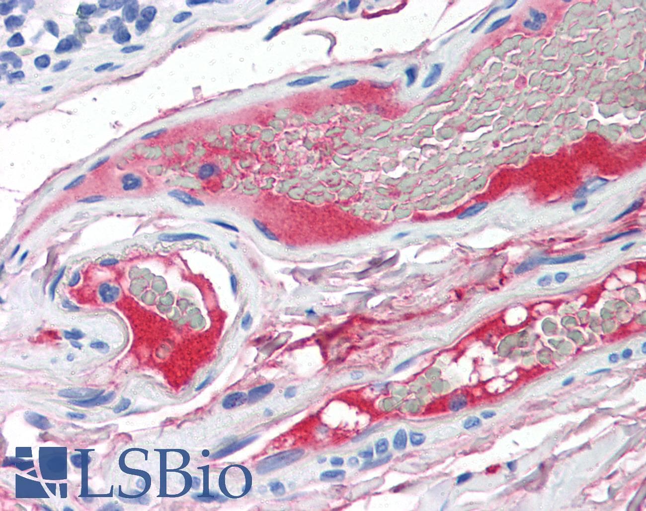 IHC-plus™ Monoclonal Mouse anti-Human Complement C2 Antibody (IHC, WB)