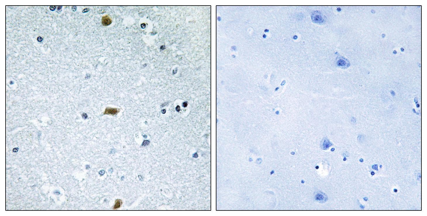 Polyclonal Rabbit anti-Human ZFHX3 / ATBF1 Antibody (IHC)