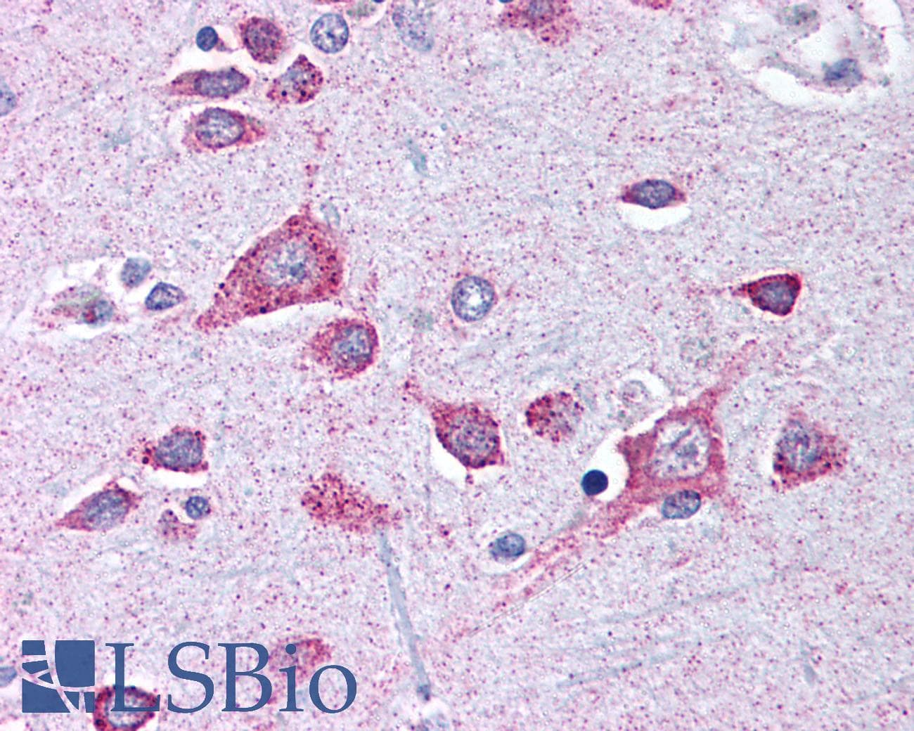 IHC-plus™ Dipeptidylpeptidase 10 / DPP10 Antibody (aa521-539)