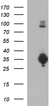 CD74 / CLIP Antibody (clone OTI1H3)
