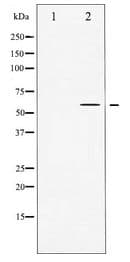 TH / Tyrosine Hydroxylase Antibody