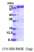 Human MX1 / MX Protein (Recombinant His)
