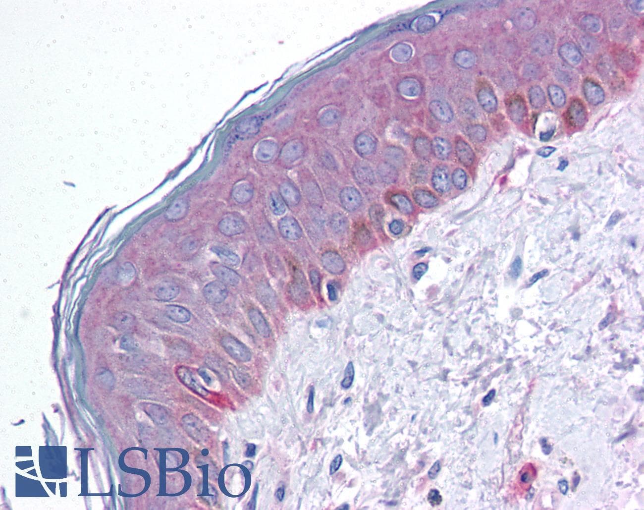 IHC-plus™ Tuberin / TSC2 Antibody (phospho-Ser664)