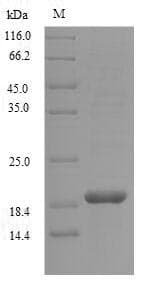 Haliotis laevigata Perlwapin Protein (Recombinant 6His, N-terminus)