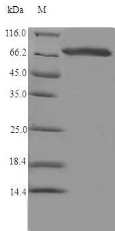 Rat CYP17 / CYP17A1 Protein (Recombinant 6His-SUMO, N-terminus)