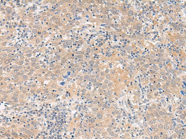 Polyclonal Rabbit anti-Human GALP / Alarin Antibody (IHC)