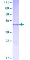 Human ADAMTS1 Protein (Recombinant GST, N-terminus)