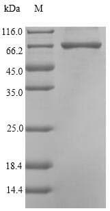 Pseudomonas cpg2 / Carboxypeptidase G2 Protein (Recombinant GST, N-terminus)