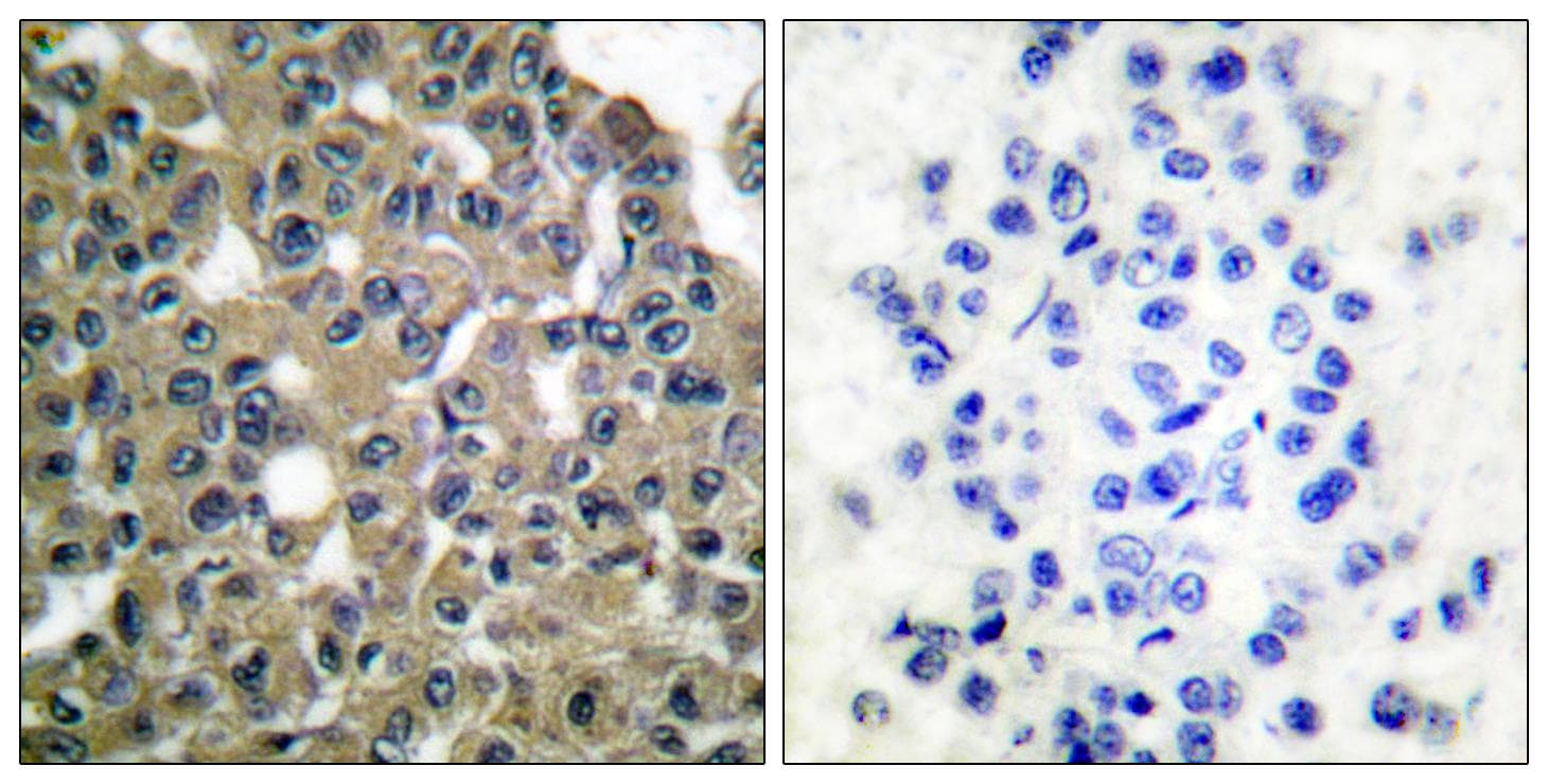 Polyclonal Rabbit anti-Human MAGEA1 / MAGE 1 Antibody (IHC, WB)