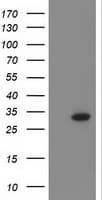 CTDSP1 / SCP1 Antibody (clone OTI1F4)