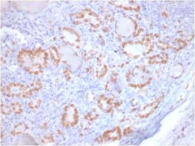 NKX2-1 / Thyroid-Specific TF Antibody (clone rNX2.1/690, Azide-free, Carrier-free)