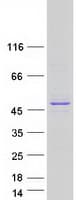 Human SMARCB1 / INI1 Protein (Recombinant Myc-DDK (Flag))