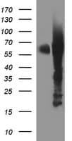 TH / Tyrosine Hydroxylase Antibody (clone OTI2D4)