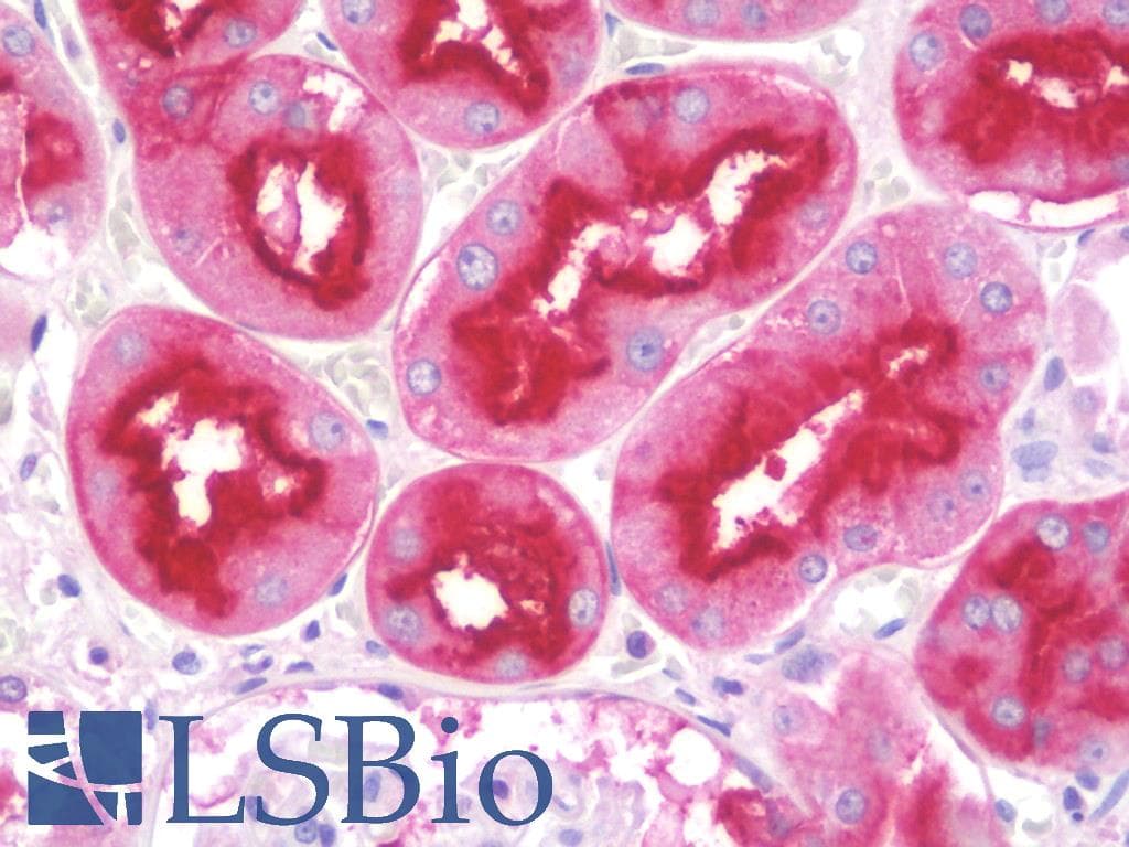 IHC-plus™ DPP4 / CD26 Antibody (clone 11D7)