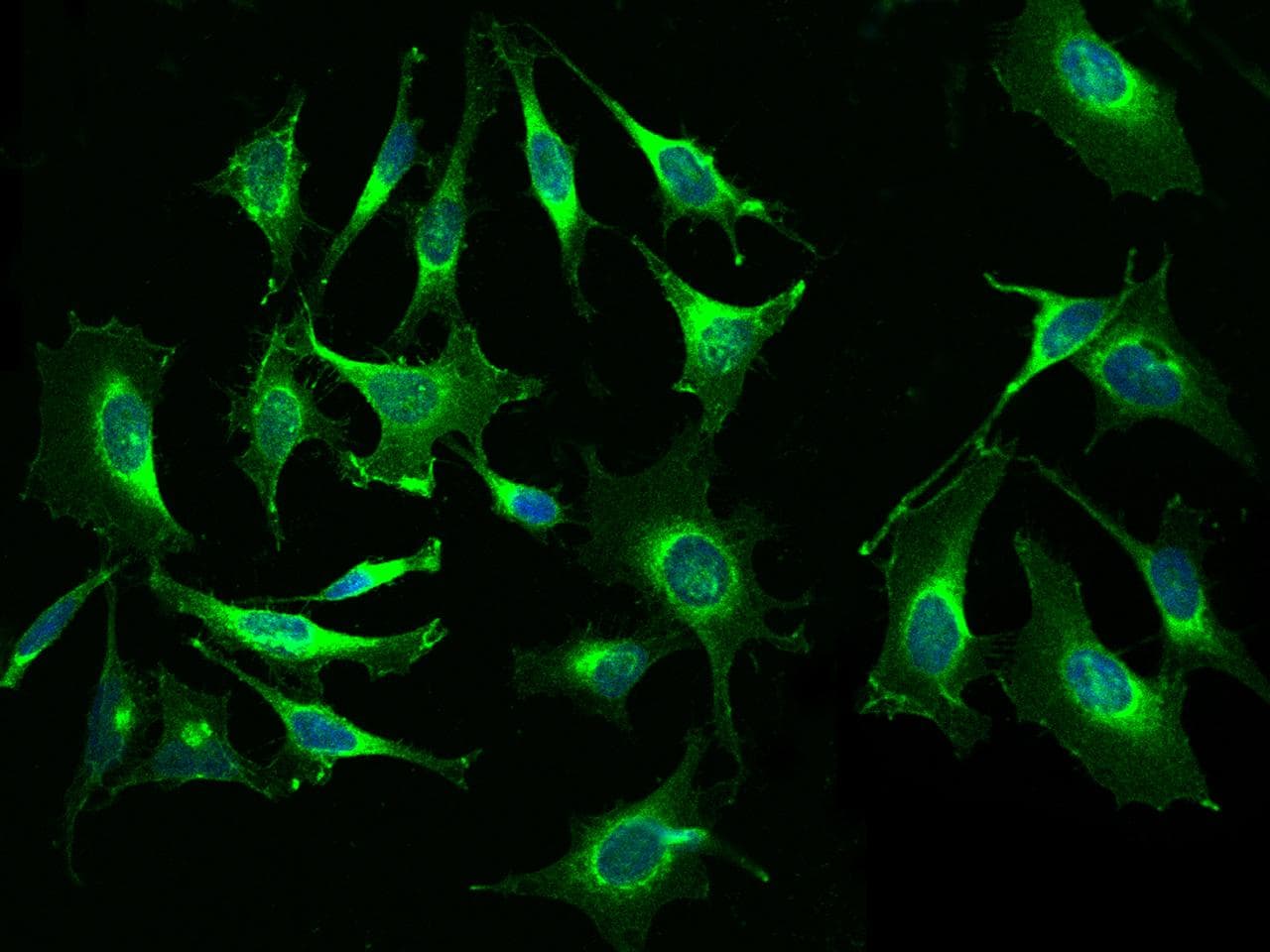 B2M / Beta 2 Microglobulin Antibody (clone 34, Preservative Free)