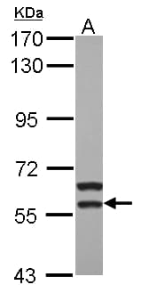 MATK Antibody